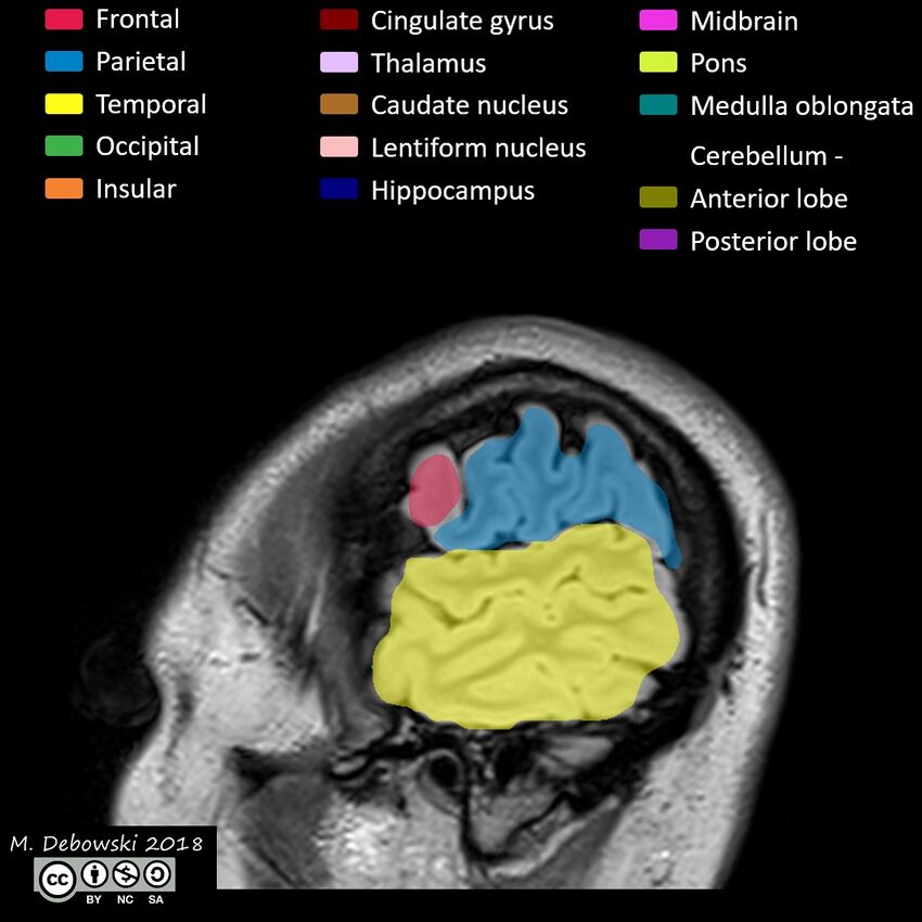 Brain lobes - annotated MRI (Radiopaedia 61691-69700 Sagittal 74).JPG
