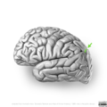 Neuroanatomy- lateral cortex (diagrams) (Radiopaedia 46670-51202 I 4).png