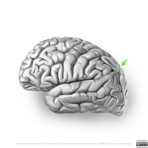 File:Neuroanatomy- lateral cortex (diagrams) (Radiopaedia 46670-51202 I 4).png