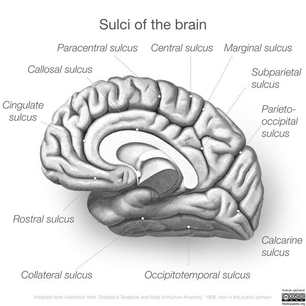 File:Neuroanatomy- medial cortex (diagrams) (Radiopaedia 47208-58969 Whole brain sulci 4).png