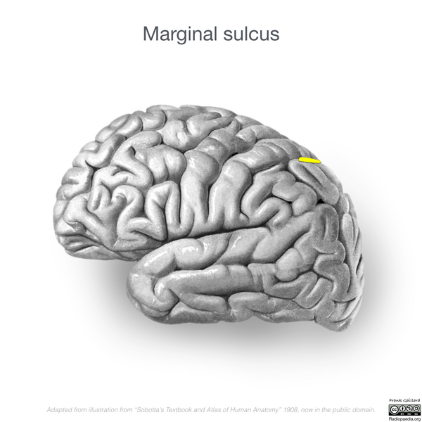 File:Neuroanatomy- lateral cortex (diagrams) (Radiopaedia 46670-51202 Marginal sulcus 2).png