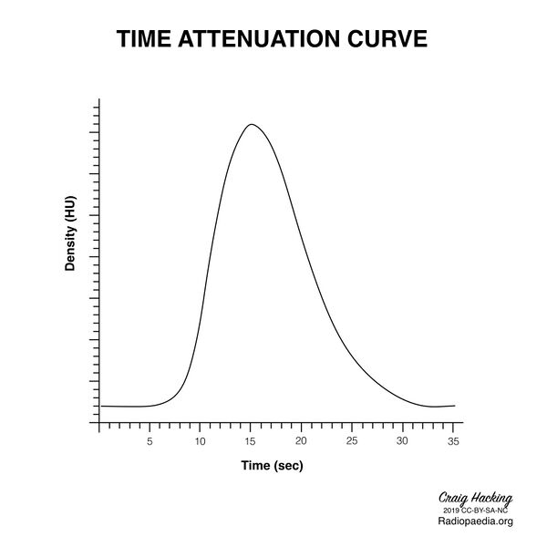 File:Brain perfusion - time attenuation curves (Radiopaedia 70313-80395 Curve generation 19).jpeg