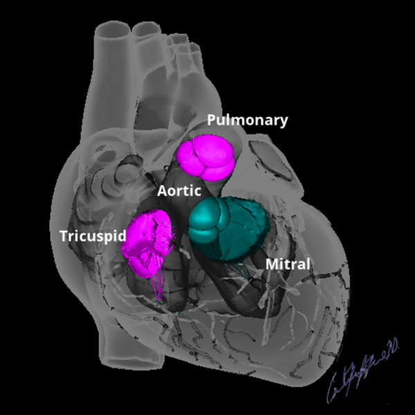 File:Cardiac valves (illustration) (Radiopaedia 74030).png