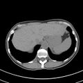 Normal multiphase CT liver (Radiopaedia 38026-39996 Axial non-contrast 10).jpg