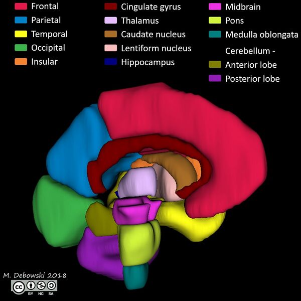 File:Brain lobes - annotated MRI (Radiopaedia 61691-69700 3D reconstruction 3).JPG