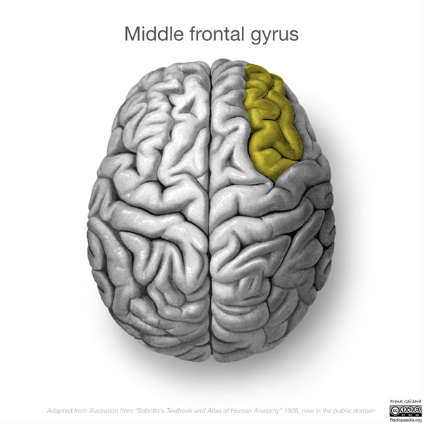 File:Neuroanatomy- superior cortex (diagrams) (Radiopaedia 59317-66670 Middle frontal gyrus 4).png