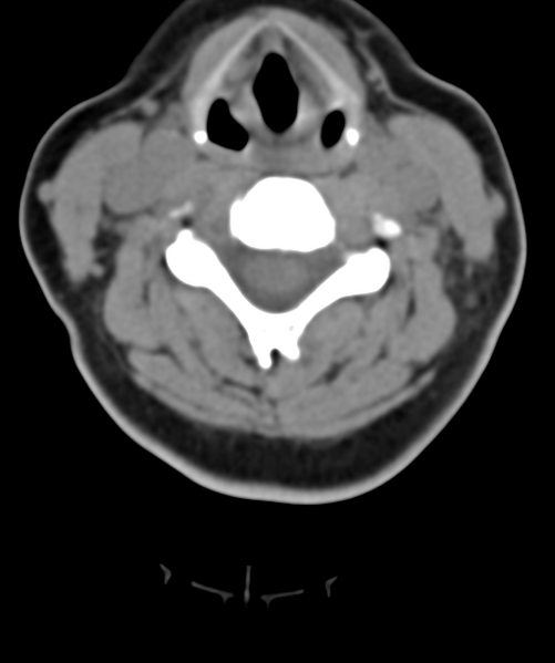 File:Normal cervical spine MRI (including Dixon) (Radiopaedia 42762-45926 Axial non-contrast 30).png