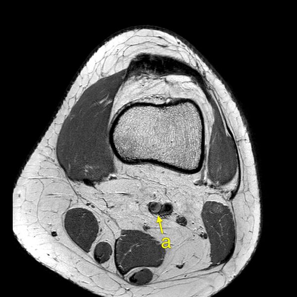 File:Anatomy Quiz (MRI knee) (Radiopaedia 43478-46866 A 2).jpeg