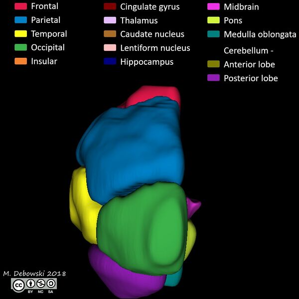 File:Brain lobes - annotated MRI (Radiopaedia 61691-69700 3D reconstruction 63).JPG