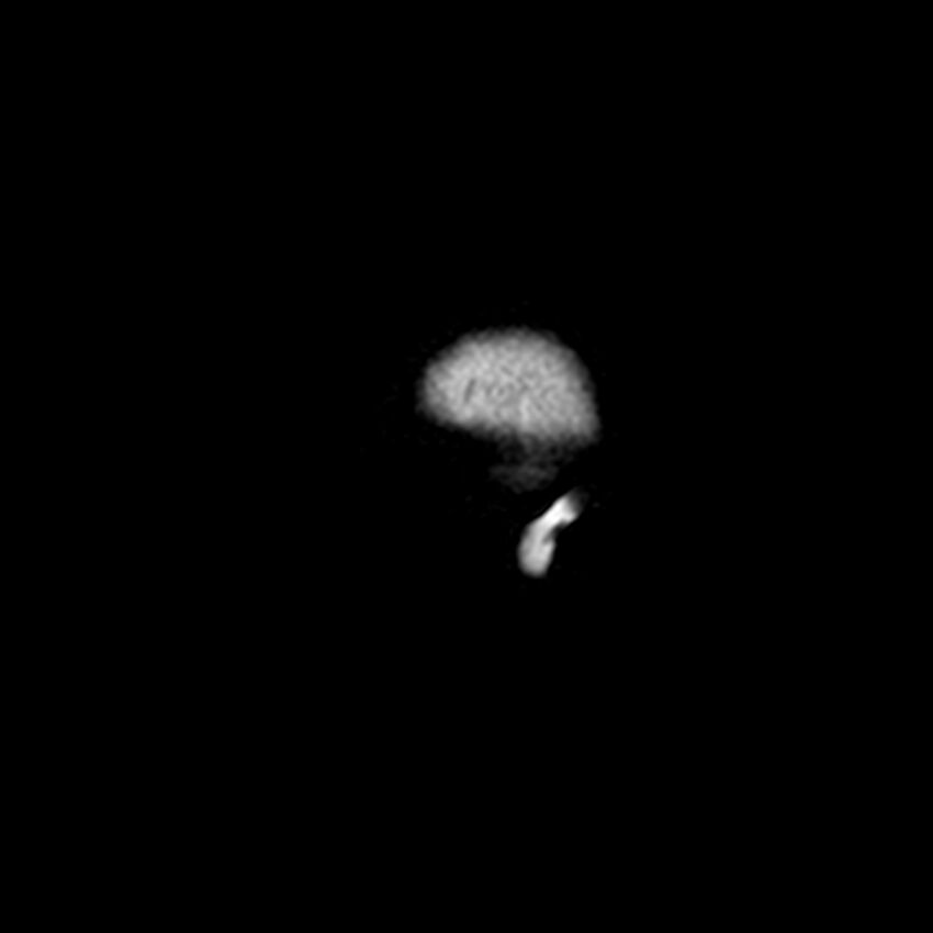 Central neurocytoma (Radiopaedia 79320-92380 Sagittal T1 2).jpg