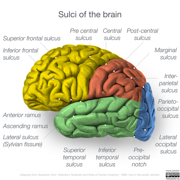 File:Neuroanatomy- lateral cortex (diagrams) (Radiopaedia 46670-51201 Brain 2).png