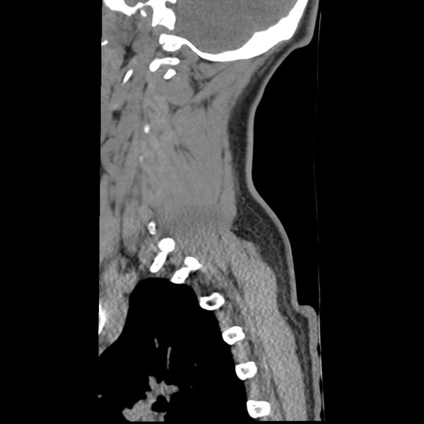 File:Normal trauma spine imaging (Radiopaedia 31753-32686 A 4).jpg