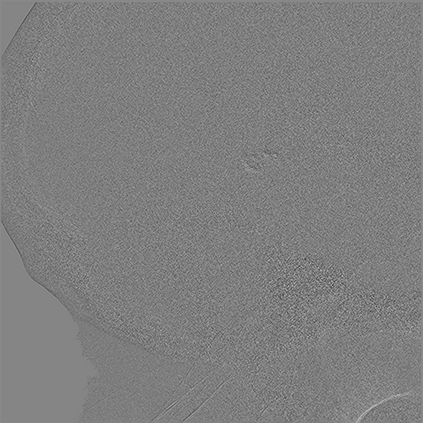 File:Normal cerebral angiogram (four vessel DSA) (Radiopaedia 41708-44649 R 4).png