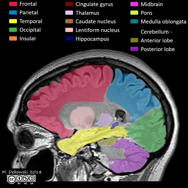 File:Brain lobes - annotated MRI (Radiopaedia 61691-69700 Sagittal 53).JPG