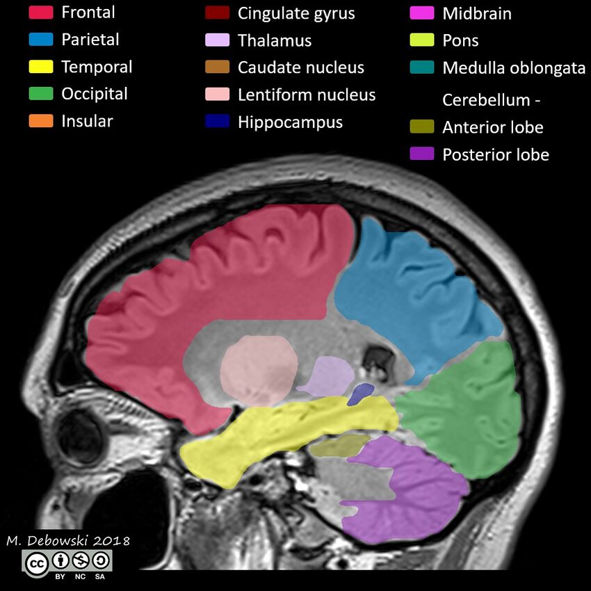 Brain lobes - annotated MRI (Radiopaedia 61691-69700 Sagittal 53).JPG