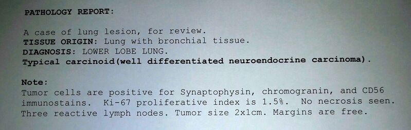 File:Bronchial carcinoid tumor (Radiopaedia 57187-64091 A 1).jpg