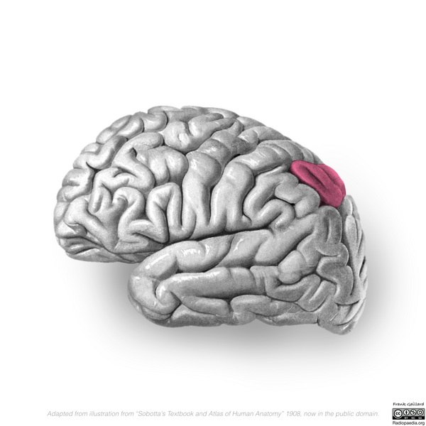File:Neuroanatomy- lateral cortex (diagrams) (Radiopaedia 46670-51313 M 4).png