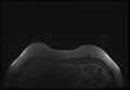 Normal breast MRI - dense breasts (Radiopaedia 80454-93850 Axial T1 13).jpg