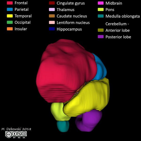 File:Brain lobes - annotated MRI (Radiopaedia 61691-69700 3D reconstruction 24).JPG