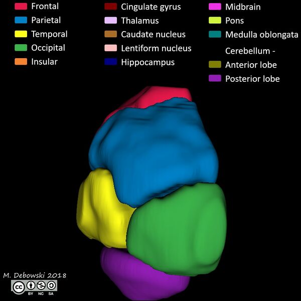 File:Brain lobes - annotated MRI (Radiopaedia 61691-69700 3D reconstruction 59).JPG