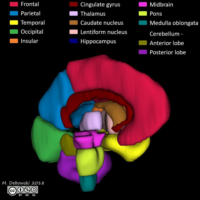 Brain lobes - annotated MRI (Radiopaedia 61691-69700 3D reconstruction 6).JPG