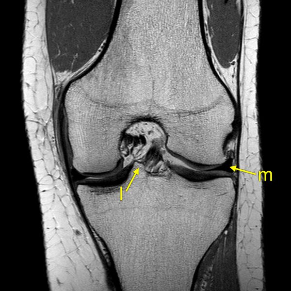File:Anatomy Quiz (MRI knee) (Radiopaedia 43478-46874 A 16).jpeg