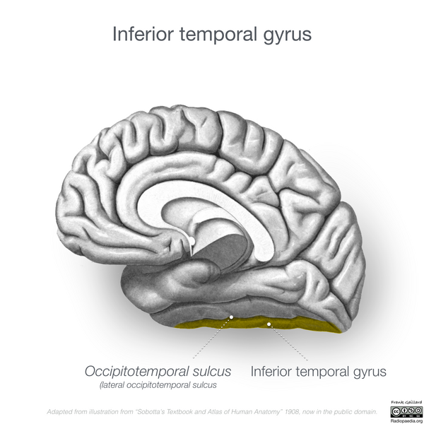 File:Neuroanatomy- medial cortex (diagrams) (Radiopaedia 47208-52697 N 3).png