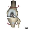 Anterior cruciate ligament injury (illustrations) (Radiopaedia 21443-21386 Figure 1 1).jpg