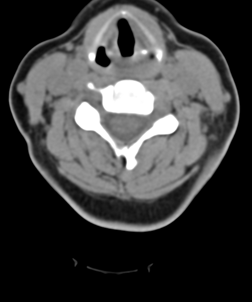 File:Normal cervical spine MRI (including Dixon) (Radiopaedia 42762-45926 Axial non-contrast 31).png
