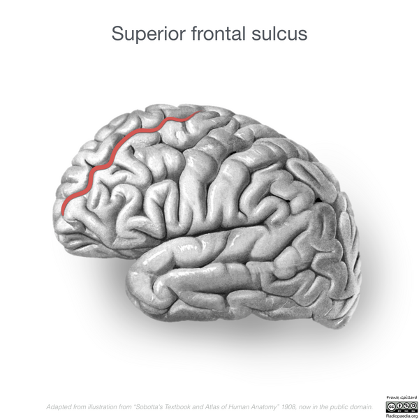 File:Neuroanatomy- lateral cortex (diagrams) (Radiopaedia 46670-51202 A 2).png