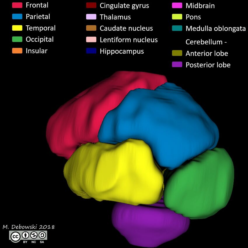 Brain lobes - annotated MRI (Radiopaedia 61691-69700 3D reconstruction 49).JPG