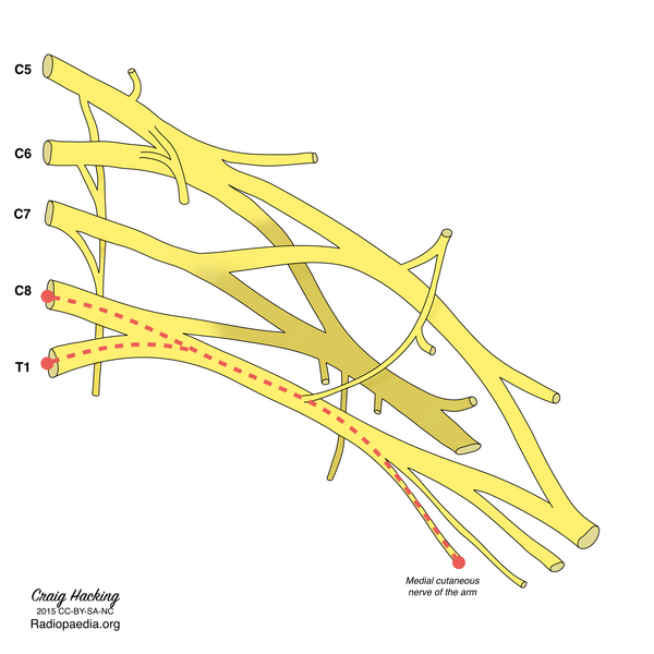 File:Brachial plexus (diagram) (Radiopaedia 37612-39492 J 1).png