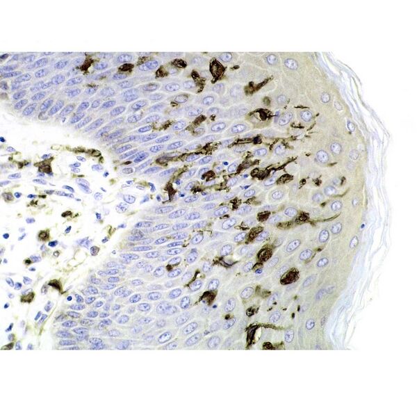 File:Langerhans cells (histology) (Radiopaedia 9168).jpg