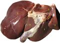 Liver (gross pathology) (Radiopaedia 36237).jpg