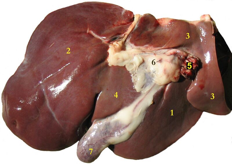 File:Liver (gross pathology) (Radiopaedia 36237).jpg