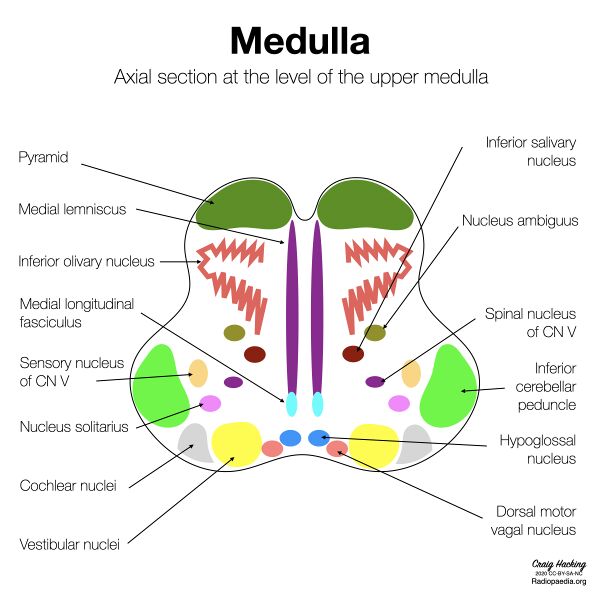 File:Brainstem cross-sectional anatomy (diagrams) (Radiopaedia 81958-95923 Upper medulla 1).jpeg