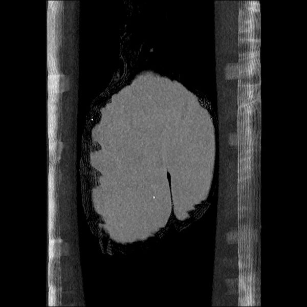 File:Normal CT angiogram of pelvis (Radiopaedia 45390-49430 B 48).jpg