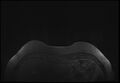 Normal breast MRI - dense breasts (Radiopaedia 80454-93850 Axial T1 9).jpg