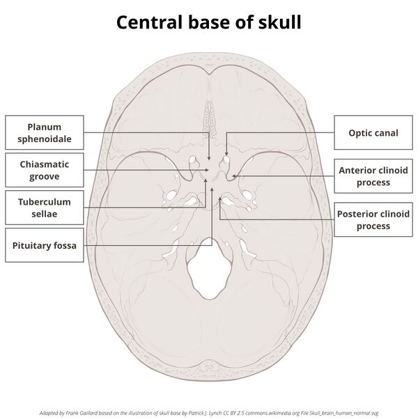 File:Base of skull (illustrations) (Radiopaedia 59251-66592 C 1).jpeg