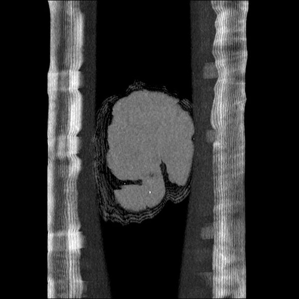 File:Normal CT angiogram of pelvis (Radiopaedia 45390-49430 B 49).jpg