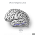 Neuroanatomy- lateral cortex (diagrams) (Radiopaedia 46670-51202 L 1).png