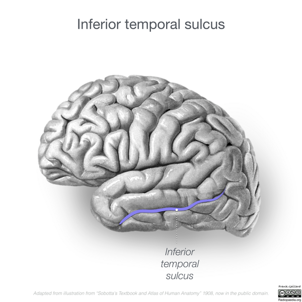 File:Neuroanatomy- lateral cortex (diagrams) (Radiopaedia 46670-51202 L 1).png