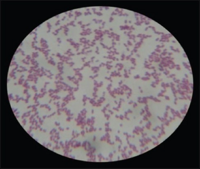 Enterococcus faecalis (microscopic view).