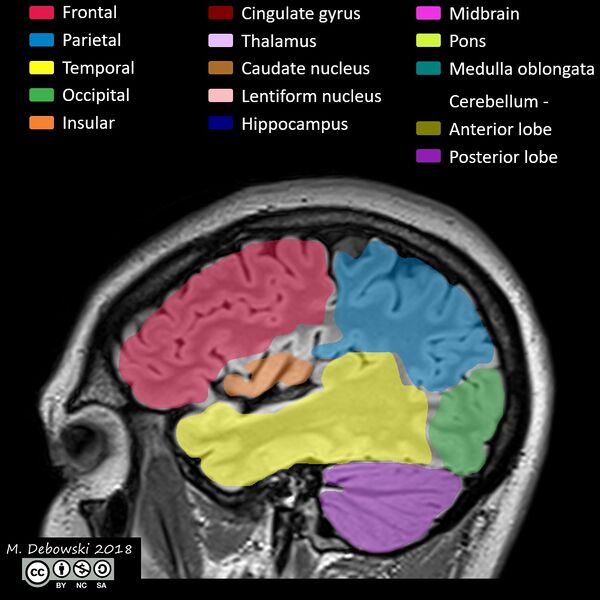 File:Brain lobes - annotated MRI (Radiopaedia 61691-69700 Sagittal 63).JPG