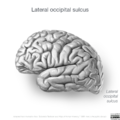 Neuroanatomy- lateral cortex (diagrams) (Radiopaedia 46670-51201 I 5).png