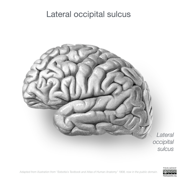 File:Neuroanatomy- lateral cortex (diagrams) (Radiopaedia 46670-51201 I 5).png