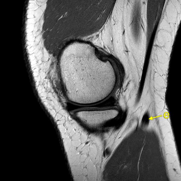 File:Anatomy Quiz (MRI knee) (Radiopaedia 43478-46865 A 4).jpeg