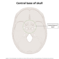 Base of skull (illustrations) (Radiopaedia 59251-66592 A 4).png