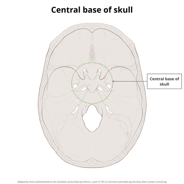 File:Base of skull (illustrations) (Radiopaedia 59251-66592 A 4).png