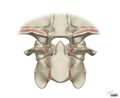 Alar and cruciform ligament anatomy (Radiopaedia 45136-49117 C 1).jpg